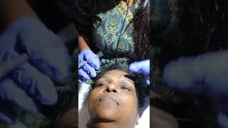 Eyebrows Microblading  Cosmetiq Clinic Trivandrum [upl. by Aipmylo]