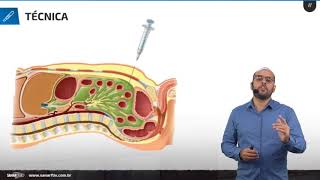 Paracentese  Aula de Procedimentos SanarFlix [upl. by April208]