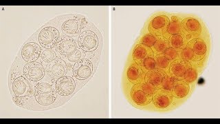 DipylidiumCaninum Infektion mit Gurkenkernbandwurm [upl. by Rockafellow]