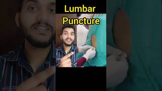 Lumbar Puncture shorts [upl. by Linc125]