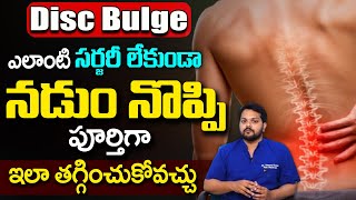 Disc bulge సమస్యలు పూర్తిగా పోవాలంటే  Lower back  l4 l5 disc bulge treatment  DrDheerajpain [upl. by Aidua]