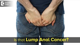 A lump down there – Is it cancer Is it Piles  Facts Revealed Dr Rajasekhar M R  Doctors Circle [upl. by Inanaup455]