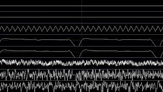 Plok Beach MultiSID Cover Attempt 1 Oscilloscope View [upl. by Hiamerej]