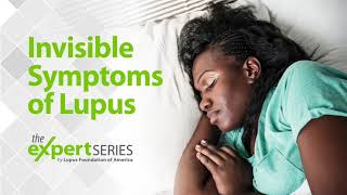 The Expert Series S6E1 Invisible Symptoms of Lupus [upl. by Moulton]