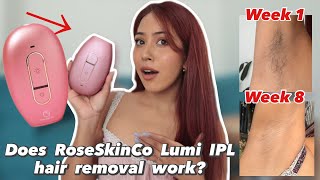 I tried IPL hair removal at home BeforeAfter Results [upl. by Lawtun409]