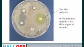 Microbiology resources  How to Measure Zones of Inhibition ZOI [upl. by Anid]