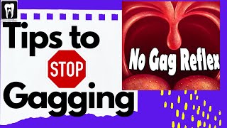 How to Suppress the Gag Reflex Permanently How to Stop a Gag Reflex How to Get Rid of Gag Reflex [upl. by Yrelav]