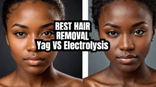 YAG Laser vs Electrolysis The Best Hair Removal for Dark Skin [upl. by Lloyd]