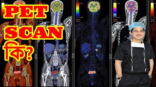 PET Scan কি health doctor rectalbleeding science constipation rectalcancer [upl. by Atlee]