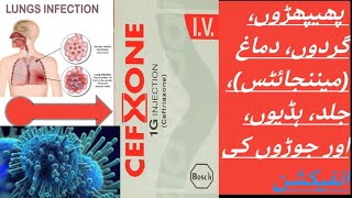 CEFXONE  CEFTRIAXONE cefxone 1g injection [upl. by Zacharie]