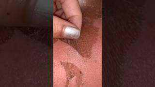 How to get rid of sunburns 👏 viral [upl. by Sisto805]