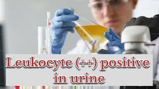 leukocytes positive in urine  symptoms causes  treatment [upl. by Yelrebmik]