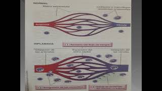 CLASE TEÓRICA 6  INFLAMACIÓN Y REPARACIÓN TISULAR PARTE 1 [upl. by Inami]