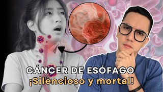 Cáncer de esófago silencioso y mortal  Dr William Guerrero [upl. by Yorel]