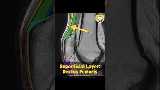 Fig 4B01 Anatomy of the Multilayered Quadriceps Tendon Part 1 [upl. by Vladi]