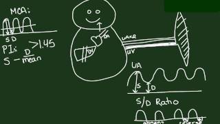 Fetal Circulation and Doppler Studies [upl. by Sabanrab]