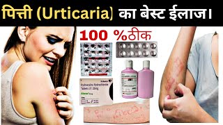 5 मिनट में पित्ती ठीक  पित्ती Urticaria का बेस्ट ईलाज  पित्ती की दवा pharmasangyan [upl. by Chisholm]