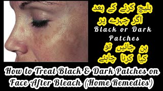 How to remove black patches from face after bleachtreat dark spots after face bleachHome Remedies [upl. by Nallac]