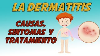 VÁRICES y CELULITIS INFECCIOSA 🦶🏼 Síntomas y Tratamiento de la Infección de Piel 🦵 Dr IVÁN GUTIÉRREZ [upl. by Murial]