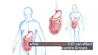 Life Science DSS Induced Colitis MP Biomedicals  Immunology [upl. by Mercie]