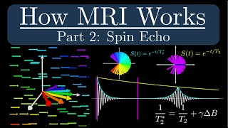 How MRI Works  Part 2  The Spin Echo [upl. by Catton]