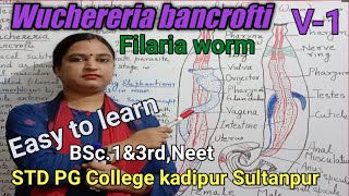 Wuchereria bancroftiFilaria WormStructure Difference btw male and female WormSTD PGC kadipur Sul [upl. by Ttegirb740]