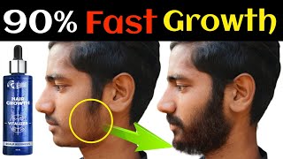 90 Beard की Growth Up कर देगा ये Beardo Hair Growth Scalp Regenesis HairBeard Tonic [upl. by Kronfeld]