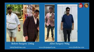 Bariatric Surgery Testimonial Patient Shares Their Journey  Bariatric Surgery Patient Feedback [upl. by Esirahs]