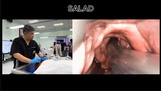 SuctionAssisted Laryngoscopy and Airway Decontamination SALAD [upl. by Rosenthal]