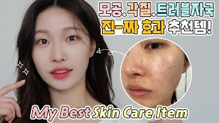 cc모공트러블자국피부좋아진 추천템✨My Best Skin Care Itemㅣ아랑 [upl. by Abram809]