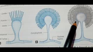 Aspergillosis  Laboratory Diagnosis  Fungal Infection MICROBIOLOGY MBBS [upl. by Gupta]