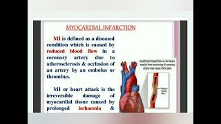 Myocardial Infarction  fully explained in Hindi  Examvila [upl. by Macdonell516]