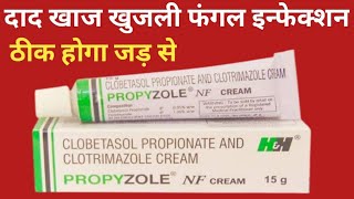 Propyzole NF Cream Uses  Clobetasol Propionate And Clotrimazole Cream  Fungul Infection दाद [upl. by Nooj]