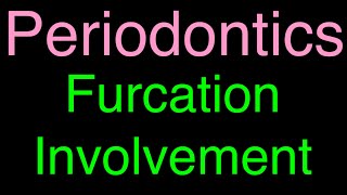 Periodontics  Furcation Involvement [upl. by Lee]