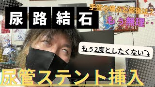 【尿路結石】ステント挿入！手術の痛みは？術後は？ [upl. by Thessa]