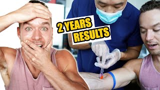 Carnivore Diet Results 2 Years Bloodwork with Dr Paul Saladino [upl. by Harbour]