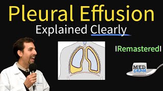 Pleural Effusions  Causes Diagnosis Symptoms Treatment [upl. by Kilah]