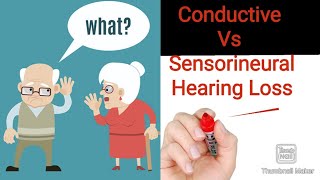 Difference Between Conductive and Sensorineural Hearing Loss  Hand Made Notes [upl. by Nader546]