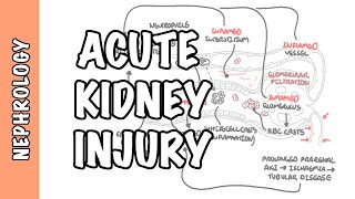 Acute Kidney Injury AKI  prerenal intrarenal and postrenal causes and pathophysiology [upl. by Acinorehs14]