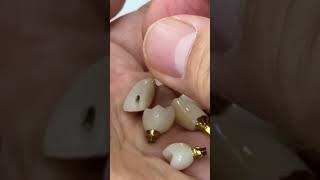 Final implants with ceramics Jewelry [upl. by Meagher335]