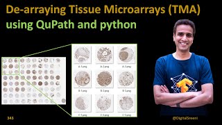 343 Dearraying Tissue Microarrays TMA using Qupath and python code [upl. by Ahsimaj]