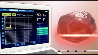 Prostate cancer laser ablation technology l 3d animation [upl. by Antony]