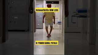 Better to go for Knee replacement totalkneereplacementsurgery drpawankamal [upl. by Brawley]