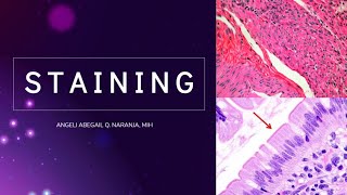 8 Staining Introduction Hematoxylin and Eosin HampE Histopathology Filipino [upl. by Aizatsana]