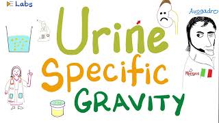 Urine specific gravity  Density  Concentrated vs Diluted Urine  Urinalysis [upl. by Ardnuassac]