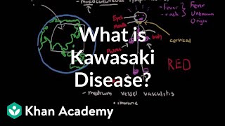 What is Kawasaki disease  Circulatory System and Disease  NCLEXRN  Khan Academy [upl. by Guilbert473]