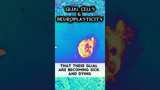 Glial Cells  Neuroplasticity amp MS  multiplesclerosis neuroplasticity rewireyourbrain shorts [upl. by Carrew]