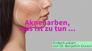 Akne Narben  Ursache amp Behandlung  Einfach erklärt von Dr Durani [upl. by Armilla97]