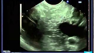 Longitudinal EUS Anatomical Guiding Structures in the Upper Abdomen Cranial  Right [upl. by Notniw]