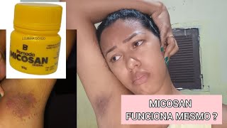 POMADA MICOSAN  funciona mesmo   a realidade da minha experiência [upl. by Melbourne]